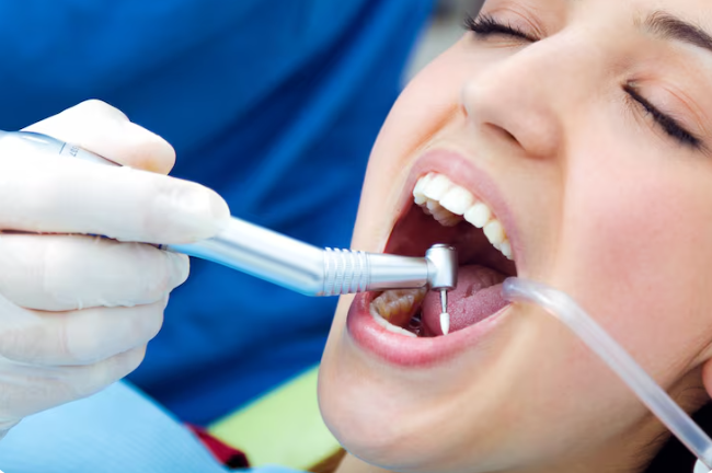 Complete Teeth Replacement Options: Which Solution Is Best for a Full Smile Restoration?